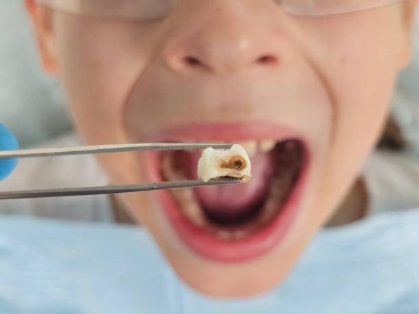 Best Pediatric Emergency Dentist in Blue Ridge, AL
